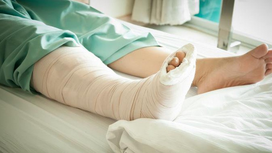 Thạch cao nhân tạo là gì? Thạch cao nhân tạo là gì?