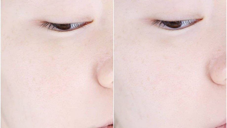 Mặt nạ bột thạch cao là gì?